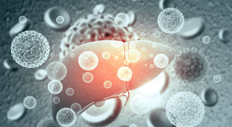 肝硬化会变成肝癌？肿瘤专家提醒：这4个因素需警惕，做好预防是关键